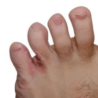 champignon entre les doigts