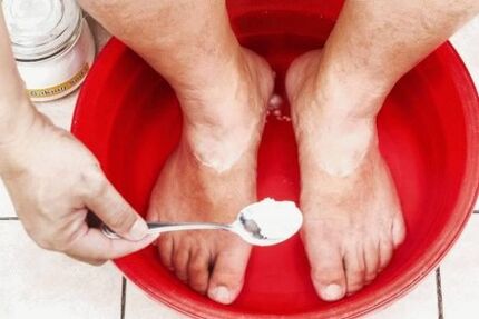 Traitement des champignons sur le pouce de la jambe